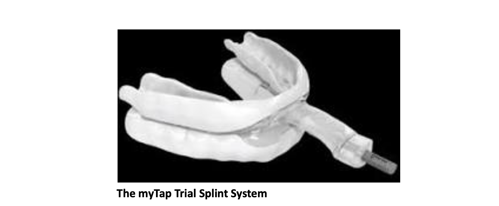 The myTap Trial Splint System